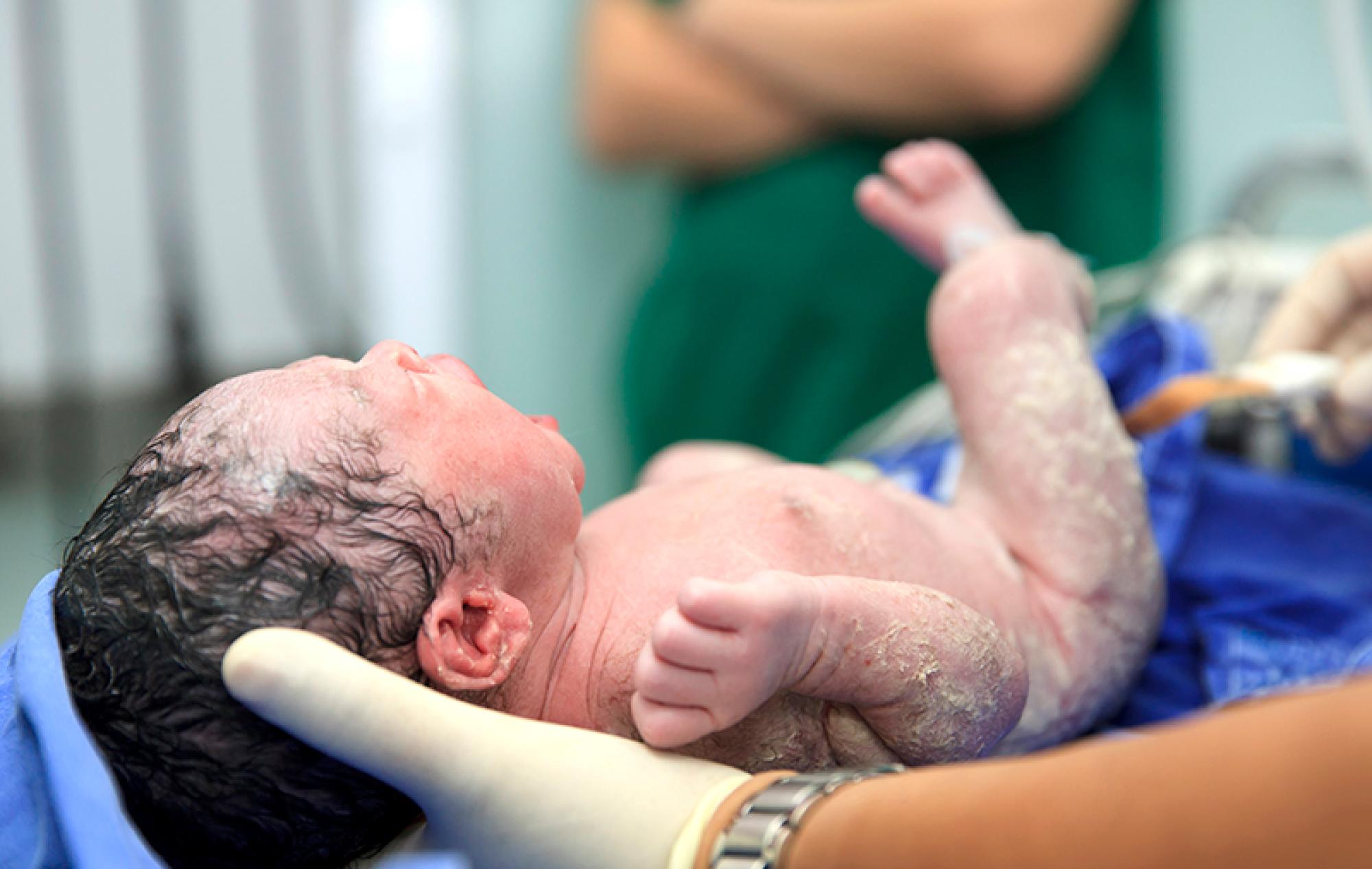 Parto vaginal com bebê sentado